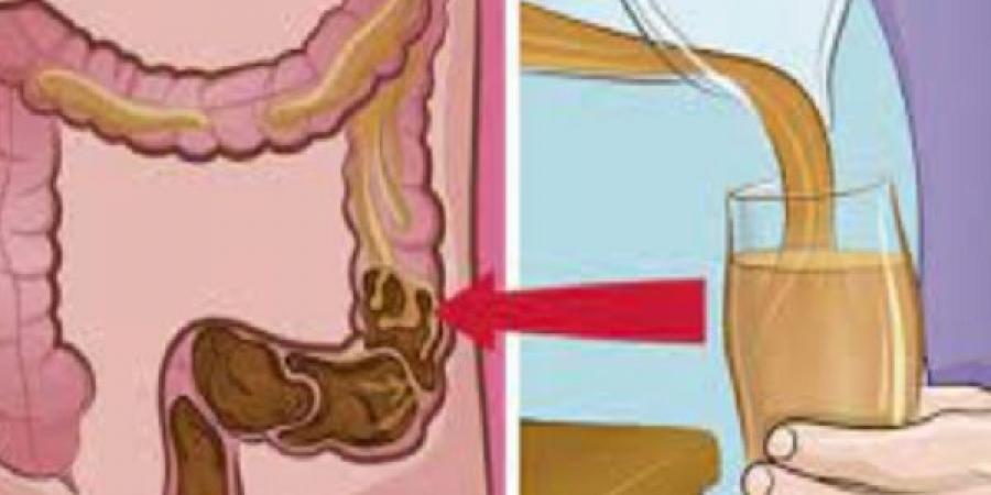 مشروبات طبيعية تساعد في تنظيف القولون